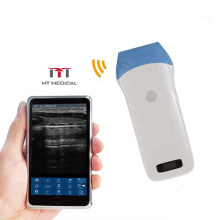 Portable Ultrasound Scanner Color Wireless Linear Probe Compatible with Phone and Tablet